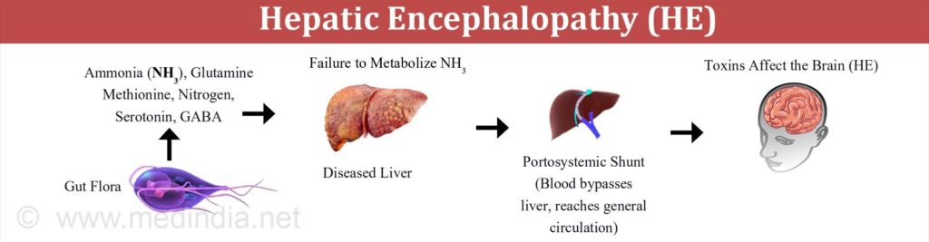 hepatic-encephalopathy-acupuncture-and-the-effects-on-the-liver